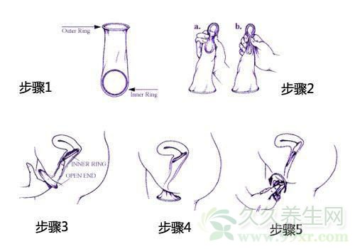 女用避孕套使用方法图解