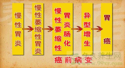 养生堂视频20130327:赵荣莱,翟兴红讲胃胀,萎缩性胃炎,胃痞