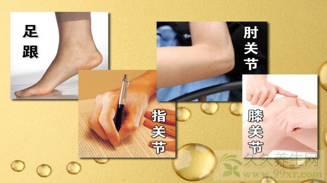 北京卫视养生堂视频20130801:钱文燕讲皮肤干痒,气血两虚,八珍汤