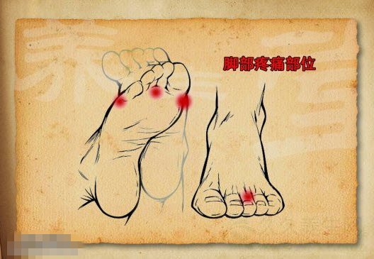 北京卫视养生堂视频20140914:怎样选鞋,踝关节损伤,足弓,脚型