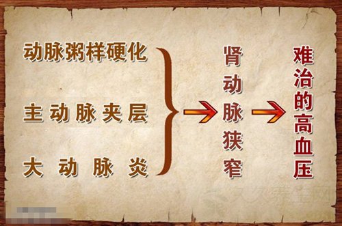 北京卫视养生堂视频20140926:郭伟讲肾动脉狭窄,高血压,尿毒症