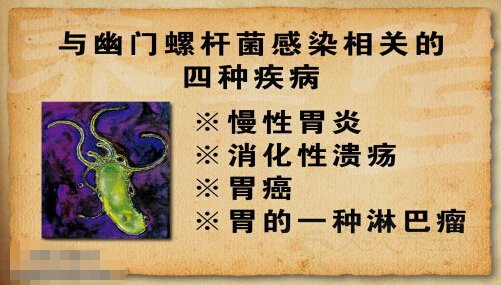 北京卫视养生堂视频20141025:丁士刚讲幽门螺旋杆菌的症状,感染