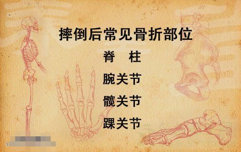 北京卫视养生堂视频20141103:老人摔倒,骨折后注意事项,驼背怎么办