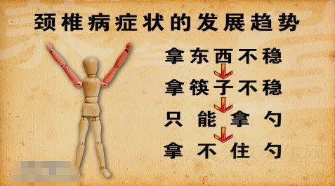 颈椎病症状的发展趋势