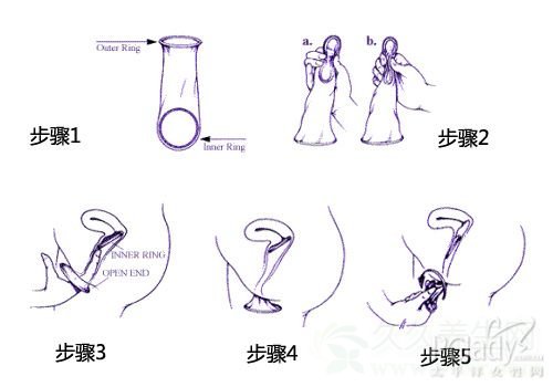 女性避孕套使用方法演示