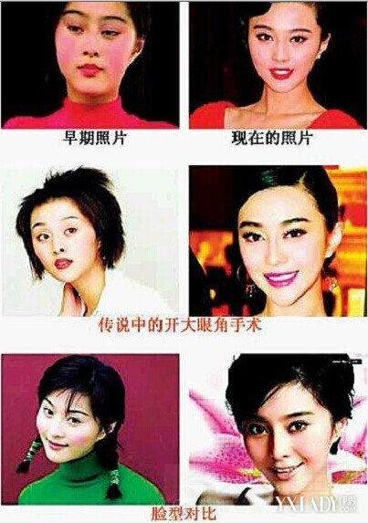 范冰冰整容前后照片