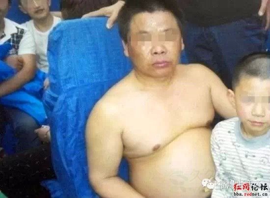 父子挤火车中暑