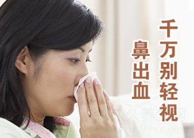 突然流鼻血怎么办