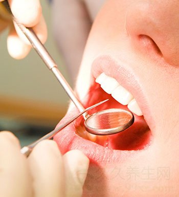 口腔健康常识 拔牙后需要注意哪些事项