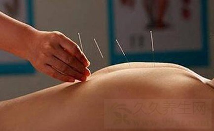 月经不调别乱吃药 针灸两个疗程治疗月经不调