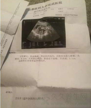 高僧治病玷污信女