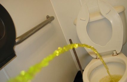 小便变黄原来是身体在排毒