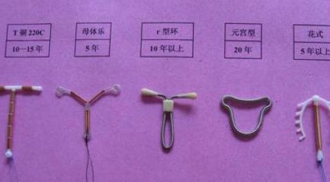 上避孕环的注意事项 上避孕环的副作用