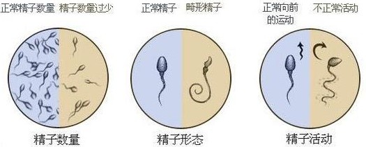 精子常规检查正常值