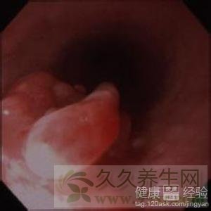 第1步
