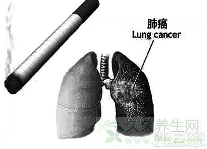 肺癌会不会传染吗