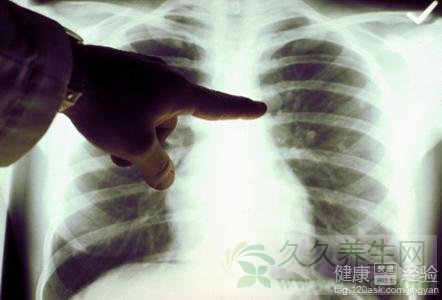 第1步