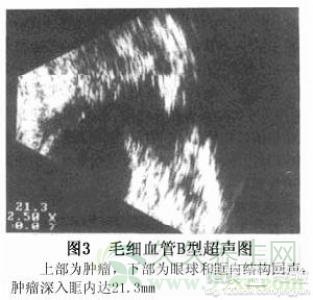 第2步
