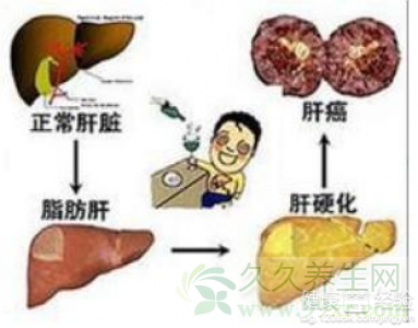 第2步
